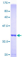 DNAL4 / Dynein Light Chain 4 Protein - 12.5% SDS-PAGE of human DNAL4 stained with Coomassie Blue