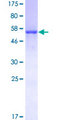 DNALI1 Protein - 12.5% SDS-PAGE of human DNALI1 stained with Coomassie Blue