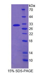DNAM-1 / CD226 Protein - Recombinant Cluster Of Differentiation 226 By SDS-PAGE