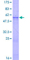 DNASE1 / DNase I Protein - 12.5% SDS-PAGE of human DNASE1 stained with Coomassie Blue