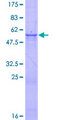 DNASE1 / DNase I Protein - 12.5% SDS-PAGE of human DNASE1 stained with Coomassie Blue
