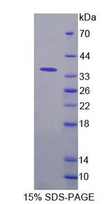 DNASE1L1 Protein - Recombinant Deoxyribonuclease X (DNASEX) by SDS-PAGE