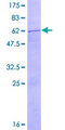 DNASE2 / DNase II Protein - 12.5% SDS-PAGE of human DNASE2 stained with Coomassie Blue