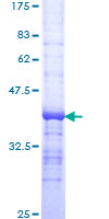 DNASE2 / DNase II Protein - 12.5% SDS-PAGE Stained with Coomassie Blue.