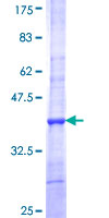 DNASE2B Protein - 12.5% SDS-PAGE Stained with Coomassie Blue.