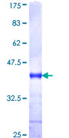 DNER / BET Protein - 12.5% SDS-PAGE Stained with Coomassie Blue.