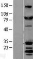 DNM1L / DRP1 Protein - Western validation with an anti-DDK antibody * L: Control HEK293 lysate R: Over-expression lysate