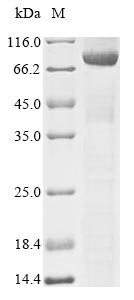 DNM1L / DRP1 Protein - (Tris-Glycine gel) Discontinuous SDS-PAGE (reduced) with 5% enrichment gel and 15% separation gel.