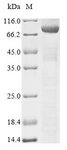 DNM1L / DRP1 Protein - (Tris-Glycine gel) Discontinuous SDS-PAGE (reduced) with 5% enrichment gel and 15% separation gel.