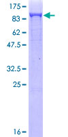 DNM1L / DRP1 Protein - 12.5% SDS-PAGE of human DNM1L stained with Coomassie Blue