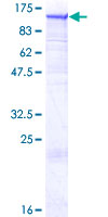 DNM2 / Dynamin-2 Protein - 12.5% SDS-PAGE of human DNM2 stained with Coomassie Blue