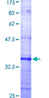 DNM2 / Dynamin-2 Protein - 12.5% SDS-PAGE Stained with Coomassie Blue.