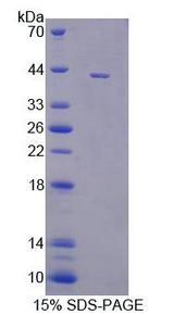 DNM3 / Dynamin 3 Protein - Recombinant Dynamin 3 (DNM3) by SDS-PAGE