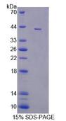 DNM3 / Dynamin 3 Protein - Recombinant Dynamin 3 (DNM3) by SDS-PAGE