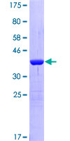 DNMT / DNMT1 Protein - 12.5% SDS-PAGE Stained with Coomassie Blue.