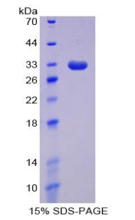 DNMT / DNMT1 Protein - Recombinant DNA Methyltransferase 1 By SDS-PAGE