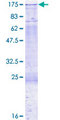 DNMT3A Protein - 12.5% SDS-PAGE of human DNMT3A stained with Coomassie Blue