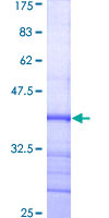 DNMT3A Protein - 12.5% SDS-PAGE Stained with Coomassie Blue.