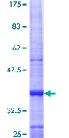 DNMT3B Protein - 12.5% SDS-PAGE Stained with Coomassie Blue.