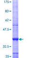DNMT3B Protein - 12.5% SDS-PAGE Stained with Coomassie Blue.