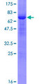 DNMT3L Protein - 12.5% SDS-PAGE of human DNMT3L stained with Coomassie Blue