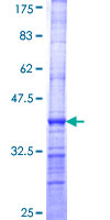 DNMT3L Protein - 12.5% SDS-PAGE Stained with Coomassie Blue.