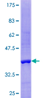 DNT / NT5C Protein - 12.5% SDS-PAGE of human NT5C stained with Coomassie Blue