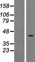 DNTNP / FAM53A Protein - Western validation with an anti-DDK antibody * L: Control HEK293 lysate R: Over-expression lysate