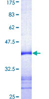 DNTT / TdT Protein - 12.5% SDS-PAGE Stained with Coomassie Blue.