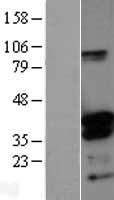 DNTTIP1 / TDIF1 Protein - Western validation with an anti-DDK antibody * L: Control HEK293 lysate R: Over-expression lysate