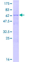 DNTTIP1 / TDIF1 Protein - 12.5% SDS-PAGE of human DNTTIP1 stained with Coomassie Blue