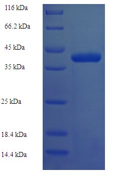 DNTTIP1 / TDIF1 Protein