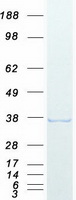 DNTTIP1 / TDIF1 Protein - Purified recombinant protein DNTTIP1 was analyzed by SDS-PAGE gel and Coomassie Blue Staining