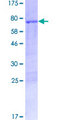 DOC2B Protein - 12.5% SDS-PAGE of human DOC2B stained with Coomassie Blue