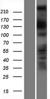 DOCK11 Protein - Western validation with an anti-DDK antibody * L: Control HEK293 lysate R: Over-expression lysate