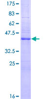 DOCK180 / DOCK1 Protein - 12.5% SDS-PAGE of human DOCK1 stained with Coomassie Blue