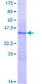 DOCK180 / DOCK1 Protein - 12.5% SDS-PAGE of human DOCK1 stained with Coomassie Blue