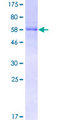 DOCK2 Protein - 12.5% SDS-PAGE of human DOCK2 stained with Coomassie Blue