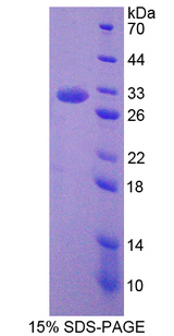 DOCK2 Protein - Recombinant  Dedicator Of Cytokinesis 2 By SDS-PAGE