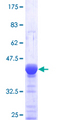 DOCK4 Protein - 12.5% SDS-PAGE Stained with Coomassie Blue.