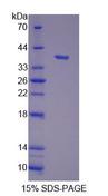 DOCK4 Protein - Recombinant Dedicator Of Cytokinesis 4 By SDS-PAGE