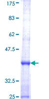 DOCK5 Protein - 12.5% SDS-PAGE Stained with Coomassie Blue.