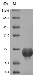 DOCK8 Protein - (Tris-Glycine gel) Discontinuous SDS-PAGE (reduced) with 5% enrichment gel and 15% separation gel.