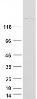 DOCK8 Protein - Purified recombinant protein DOCK8 was analyzed by SDS-PAGE gel and Coomassie Blue Staining