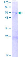 DOK4 Protein - 12.5% SDS-PAGE of human DOK4 stained with Coomassie Blue
