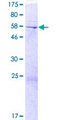DOK4 Protein - 12.5% SDS-PAGE of human DOK4 stained with Coomassie Blue