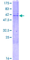 DOK5 Protein - 12.5% SDS-PAGE of human DOK5 stained with Coomassie Blue