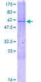 DOK5 Protein - 12.5% SDS-PAGE of human DOK5 stained with Coomassie Blue