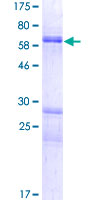 DOK6 Protein - 12.5% SDS-PAGE of human DOK6 stained with Coomassie Blue