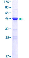 DPCD Protein - 12.5% SDS-PAGE of human RP11-529I10.4 stained with Coomassie Blue